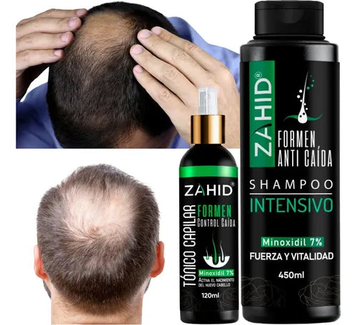 Shampoo Intensive Minoxidil 7% Tratamiento® + Tónico Capilar OBSEQUIO
