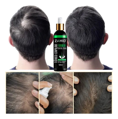 Shampoo Intensive Minoxidil 7% Tratamiento® + Tónico Capilar OBSEQUIO