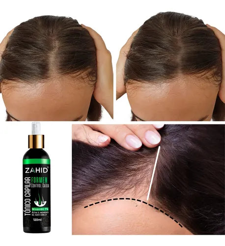 Shampoo Intensive Minoxidil 7% Tratamiento® + Tónico Capilar OBSEQUIO